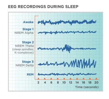 chart of eeg recordings during sleep 